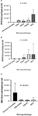 Investigating the role of Epstein-Barr virus and human papillomavirus types 16 and 18 co-infections in cervical disease of Iranian women